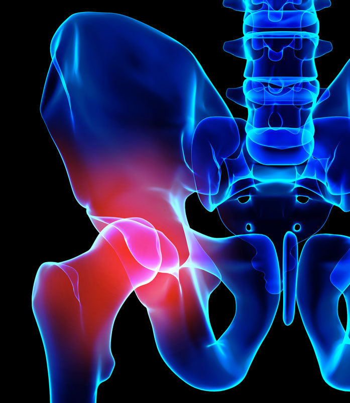 xray of hip pain